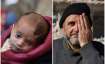Left- Baby Karim, Right- A man covering his left eye in